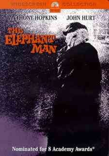 The Elephant Man